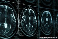 When Memory Problems Warrant Immediate Attention